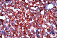 Fatty liver (fat is dyed red). Image: NIH/National Center for Advancing Translational Sciences